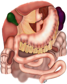 stomach and organs around