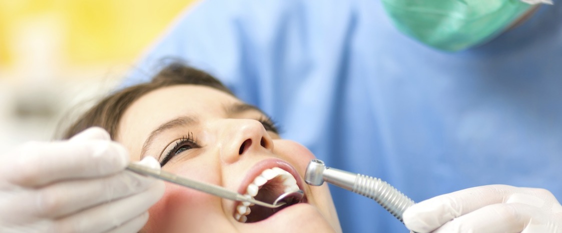 woman opening her mouth at the dentist