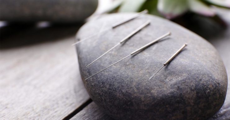 acupuncture needles on a rock